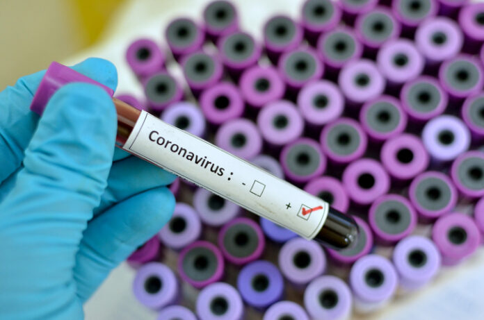 us-coronavirus-cases-surge-scott-mctominay-signs-new-deal-latest-news-global-world-stories-tuesday-june-2020-style-rave