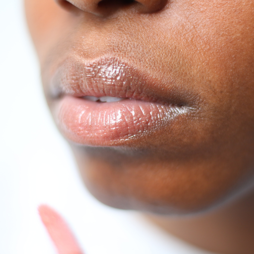 chapped-lips-natural-remedy