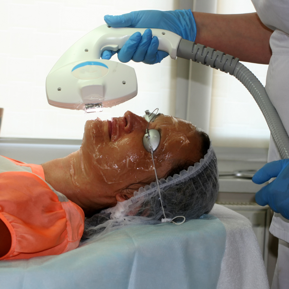 how-laser-facial-treatments-works