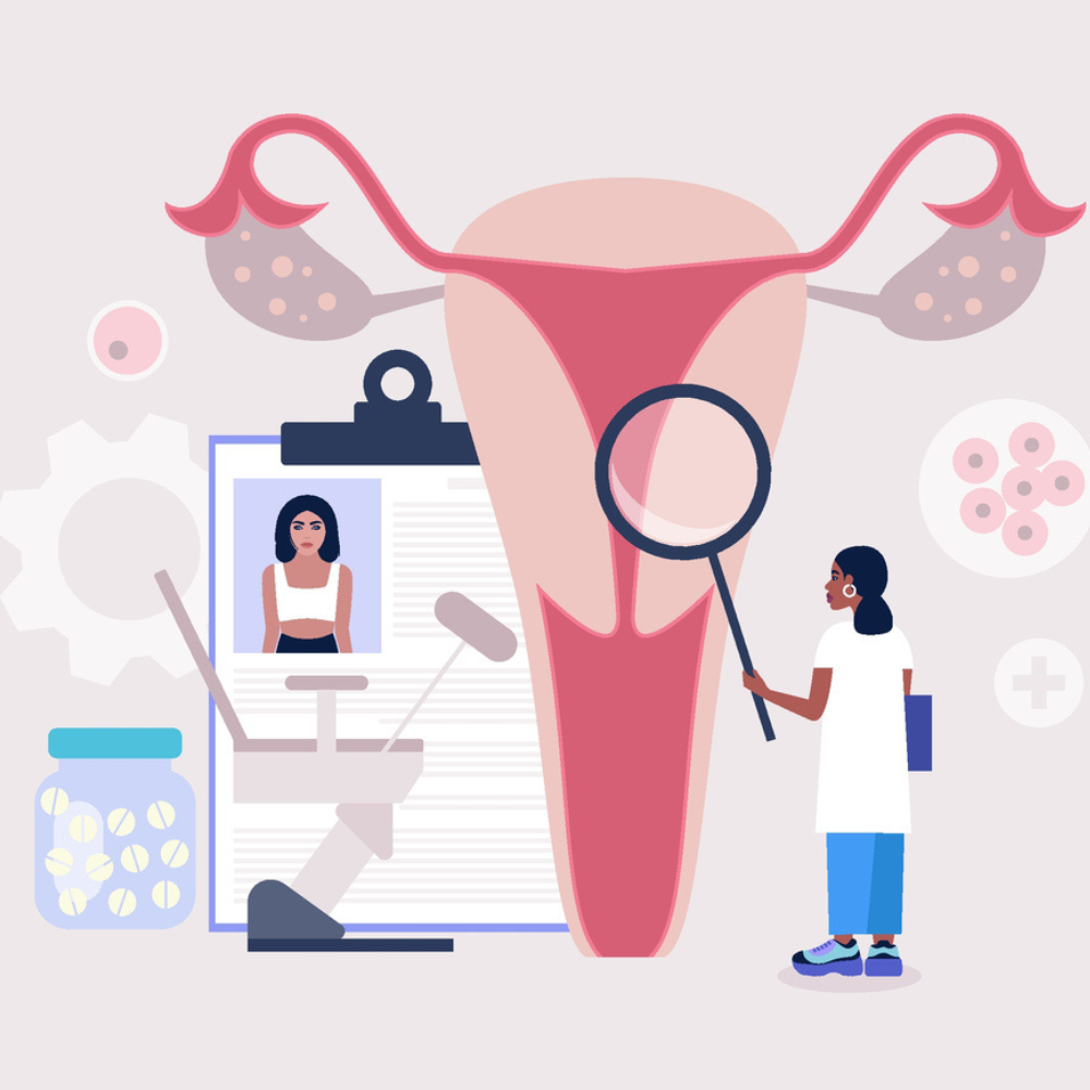 uterine-fibroids-myomectomy-scarring-style-rave