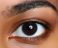 Eye discoloration causes how to whiten eyes