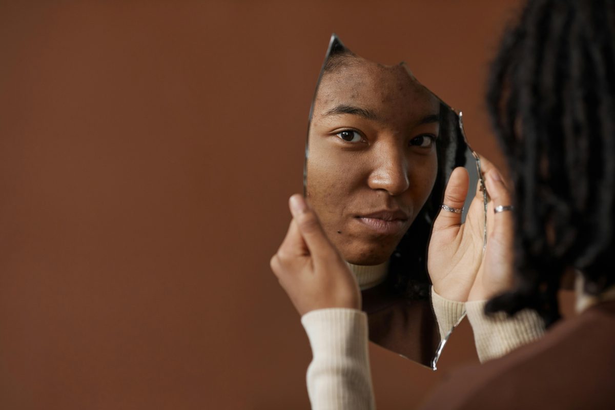 Purging Photo Skin Purging Vs Sudden Breakouts: How To Tell The Difference