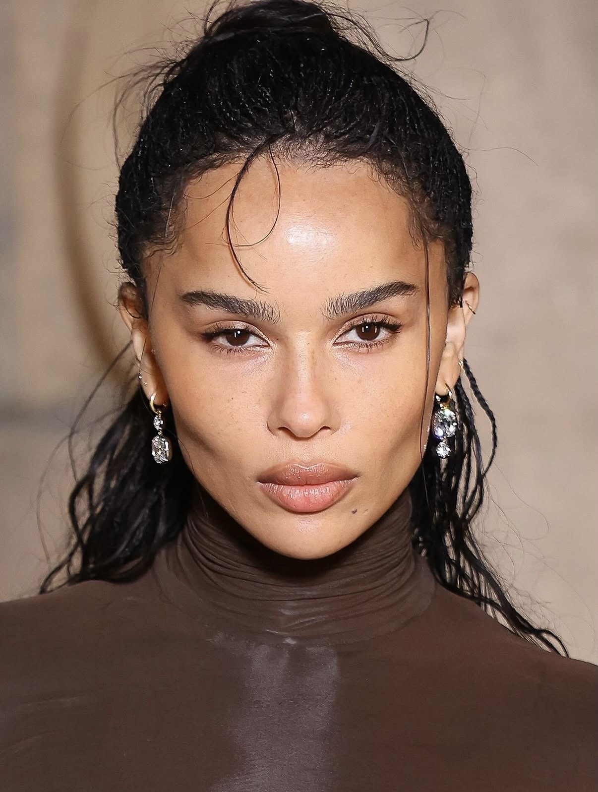 Natural-looking facial balancing results showing improved harmony between facial features — facial balancing trend 2026