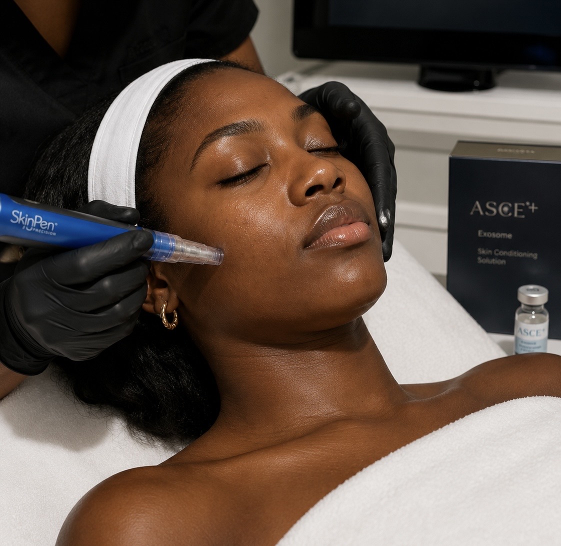 exosomes-microneedling