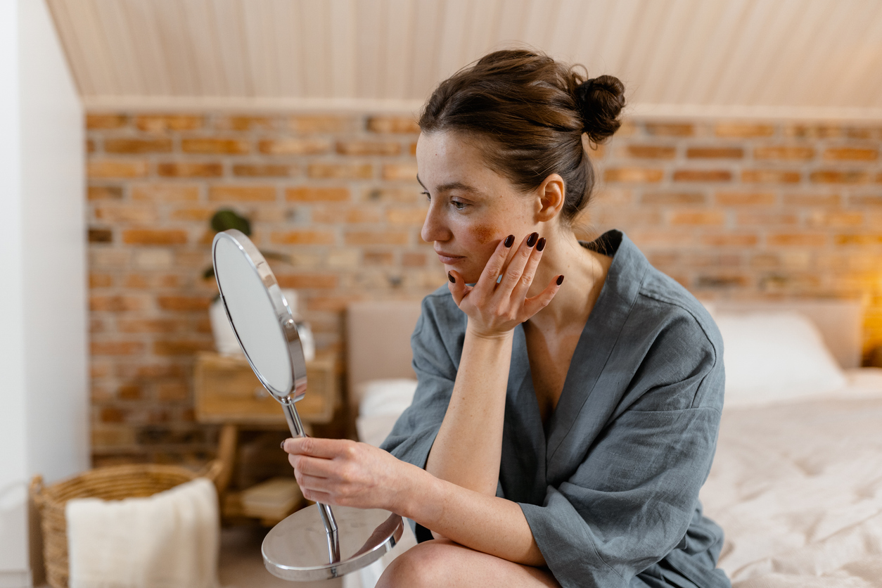 Rosacea Explained: Symptoms, Triggers, and How to Calm Flare-Ups