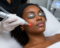 laser-skin-resurfacing-treatment-style-rave