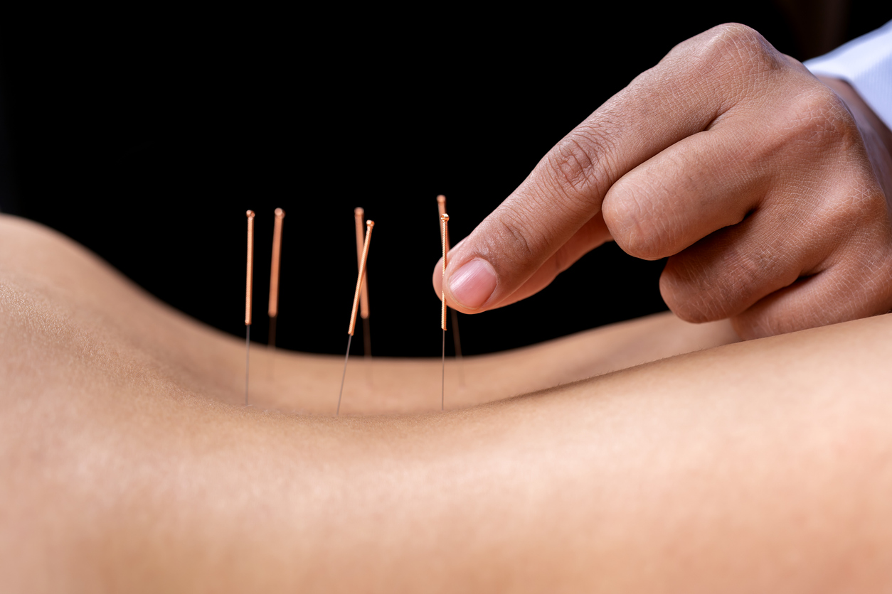 how-acupuncture-works-style-rave